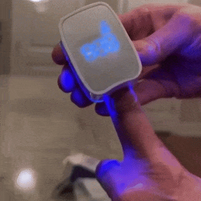 Nail Fungal Cleaning Laser Device