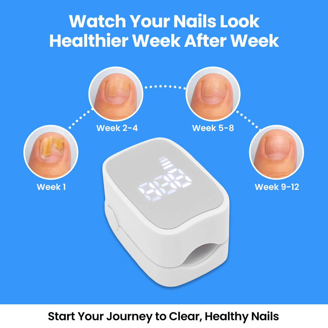 Nail Fungal Cleaning Laser Device