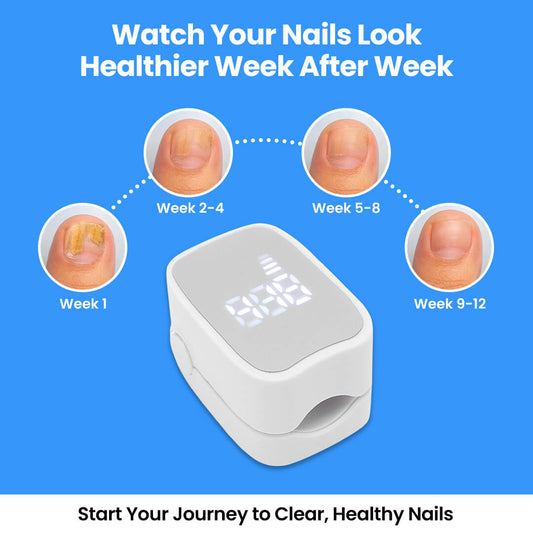 Nail Fungal Cleaning Laser Device