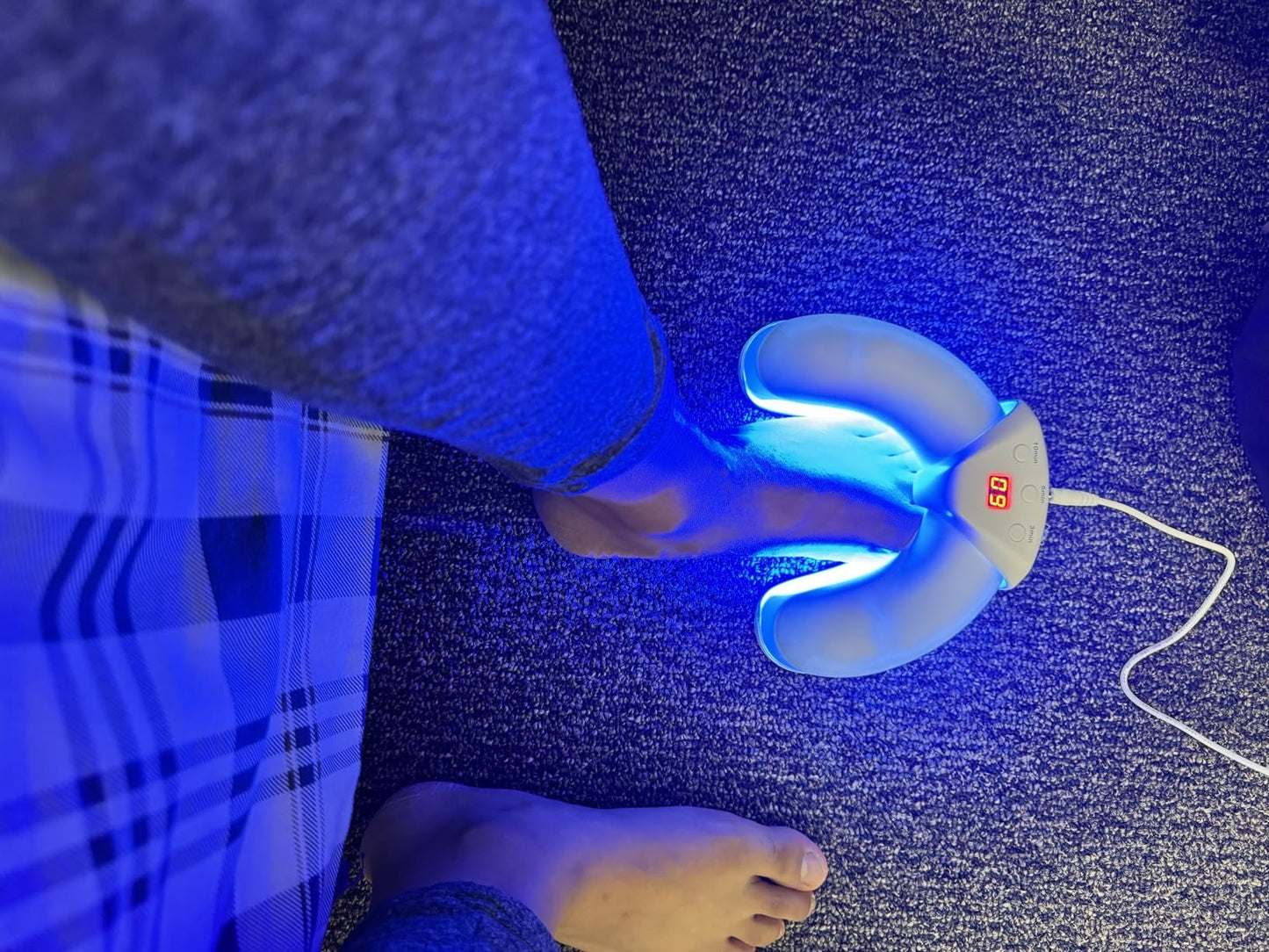 LumiCasa™ Fungal Nail Laser Device